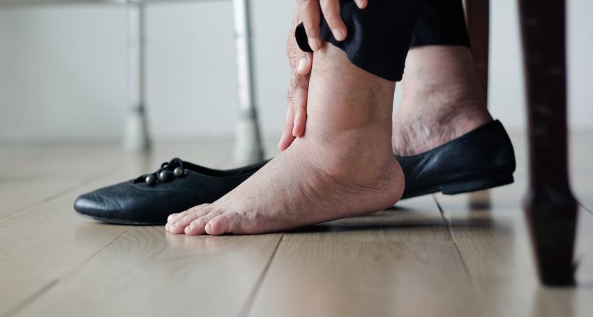 Picioare umflate și grele: cauze și soluții