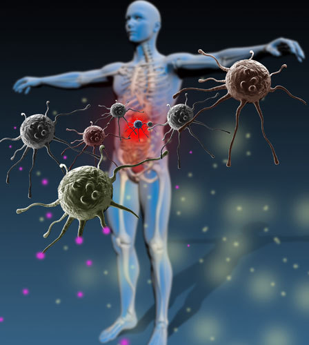 boala sistemului imunitar articular