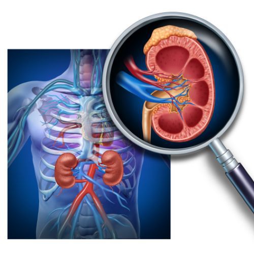 Durere de rinichi: cauze, simptome asociate si tratament