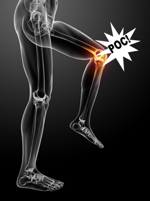 artrita genunchiului ce sa faci