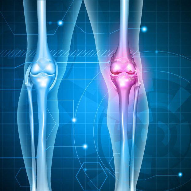 ELYTIS Hospital: Amestecul care te poate scăpa de durerile de genunchi