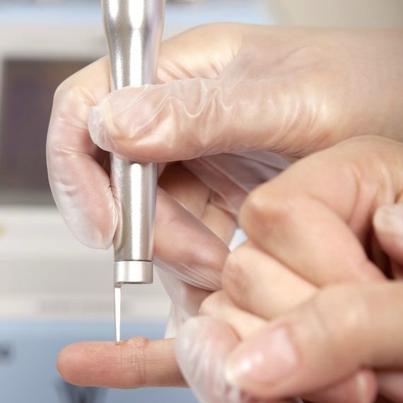 negii pot dispărea does hpv vaccine prevent cancer in males