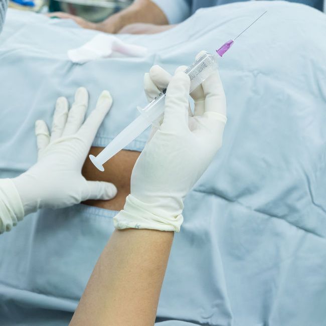 varicoză și anestezie epidurală