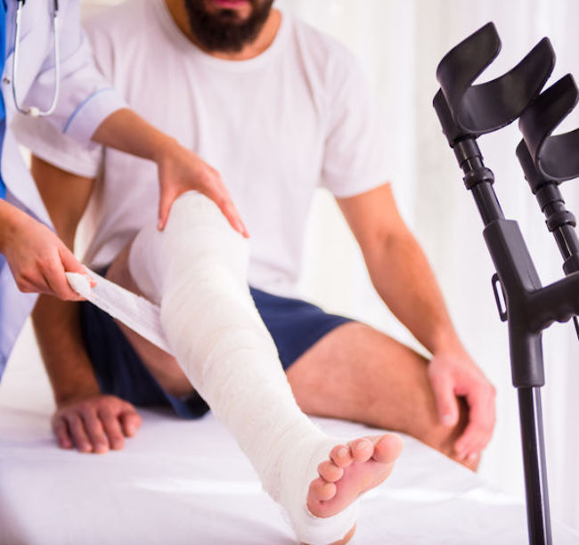 tratament articular după fracturi