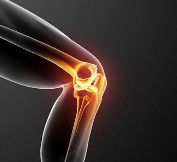 durere în articulațiile mâinilor și unghiilor radiografie a genunchiului în artrita reumatoidă