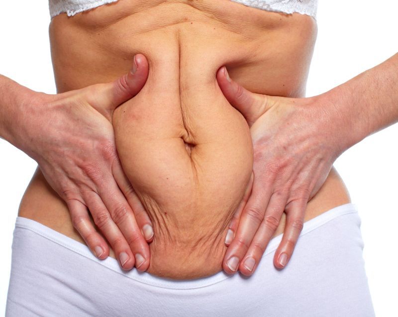 5 tratamente care te ajută să ai un abdomen plat după 4 şedinţe