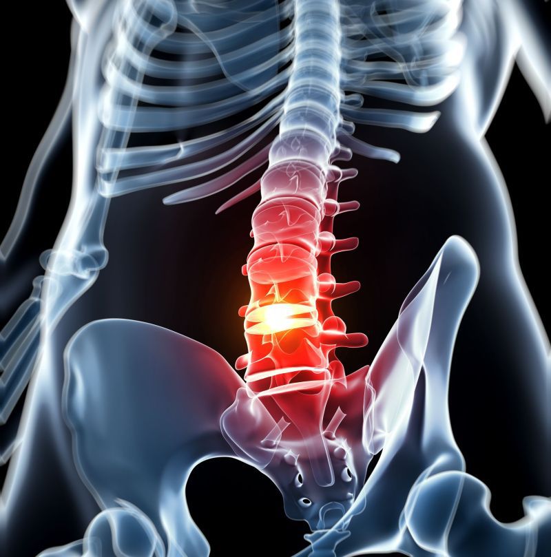 hernie a durerii coloanei vertebrale în articulația șoldului