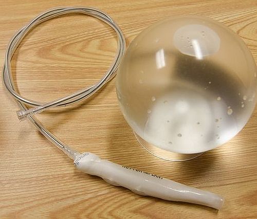 Montarea balonului intragastric pentru slăbit