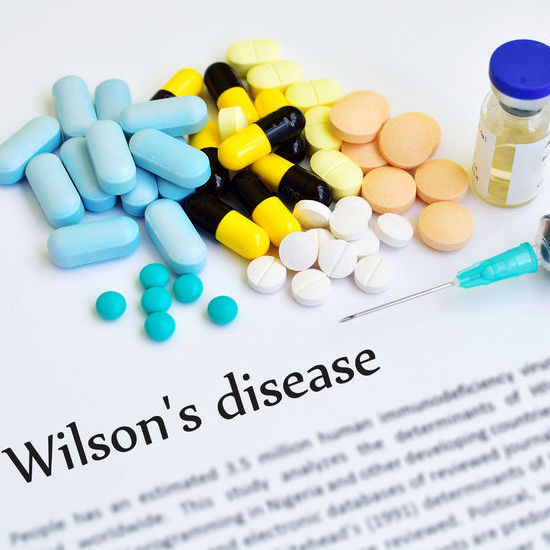 Boala Wilson simptome, diagnostic, tratament CSID Ce se întâmplă