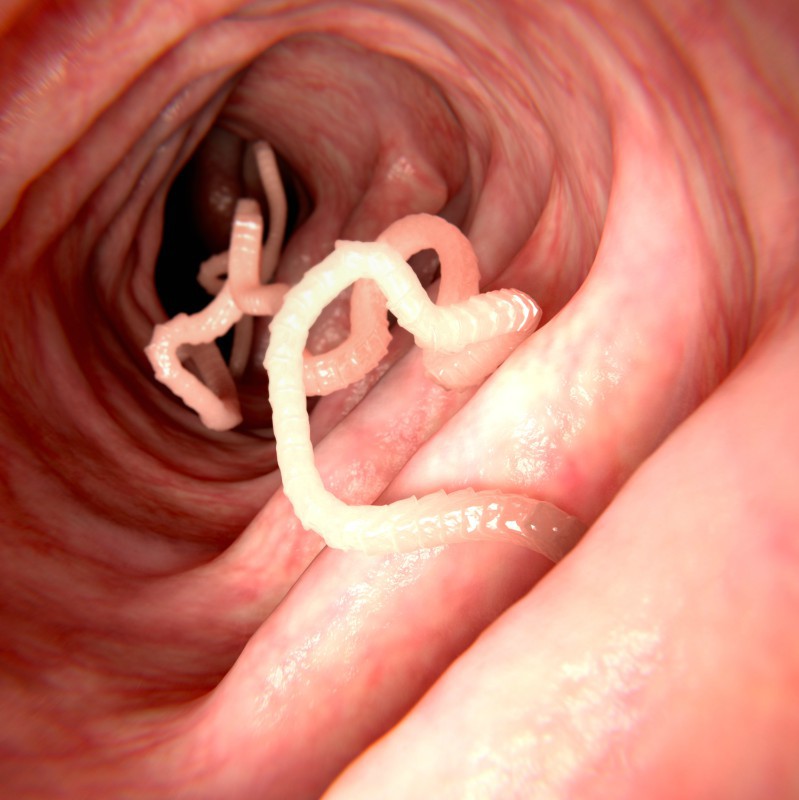 Paraziții intestinali: tratamente naturiste - Tratamente eficiente și sigure de paraziți