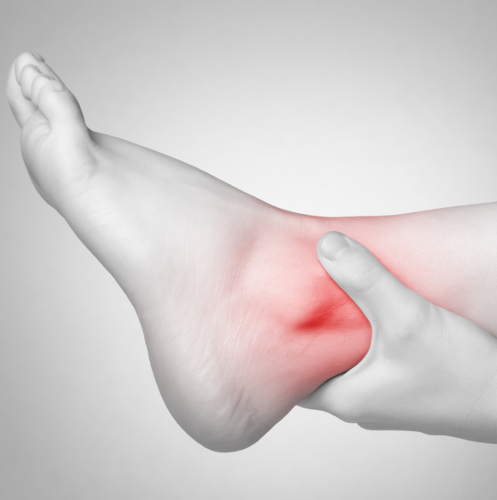 articulatia gleznei umflata dureri severe la nivelul articulațiilor picioarelor provoacă