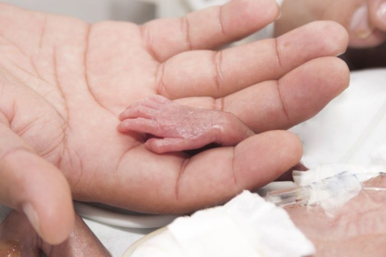 Copil născut cu malformații – cauze și analize care depistează anomaliile. Explică Andreas Vythoulkas, specialist obstetrică-ginecologie