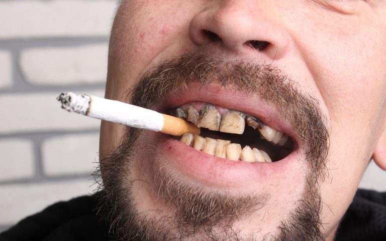 Obiceiurile care distrug dinții românilor – fumatul și consumul de alcool