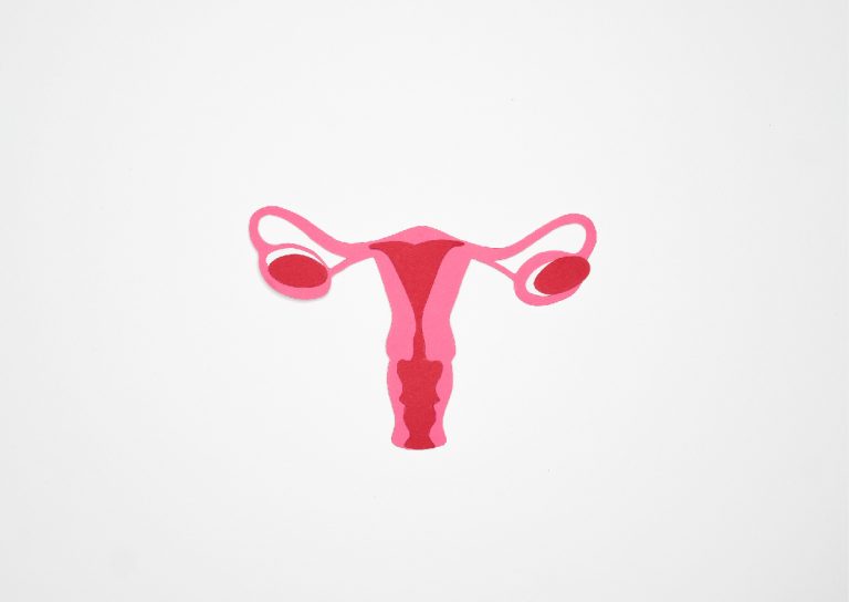 Chistul ovarian rupt: cum apare, simptome, diagnostic și tratament