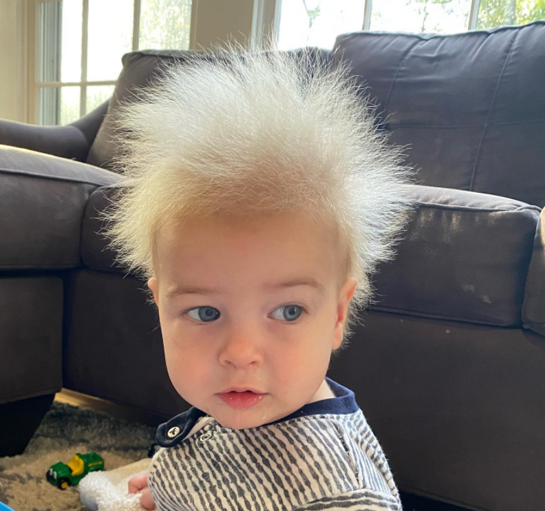 Băiețelul cu „sindromul părului de nepieptănat” care a devenit viral. Ce presupune această afecțiune