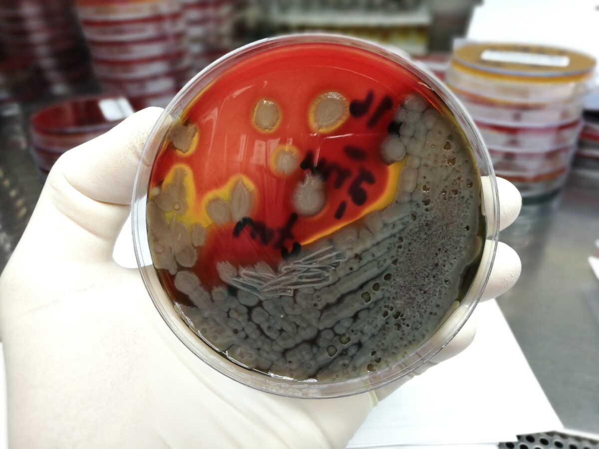 Infecția cu bacilul piocianic