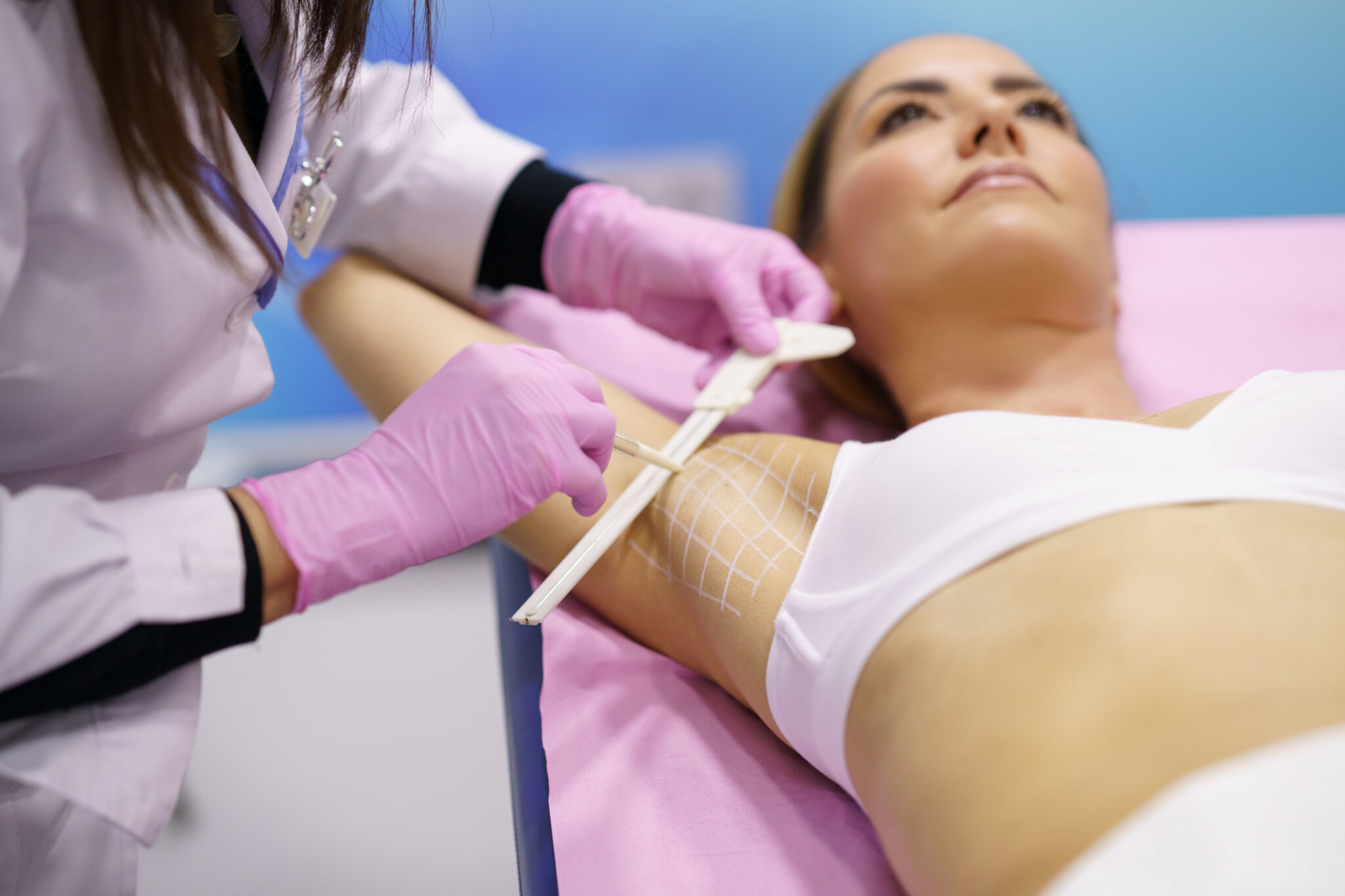 toxină botulinică pentru hiperhidroză