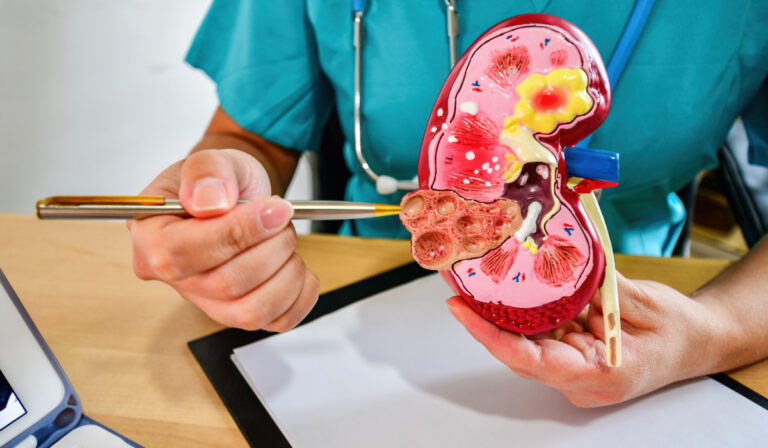 Se poate trăi cu un singur rinichi? Care este durata de viață a pacienților cu un rinichi