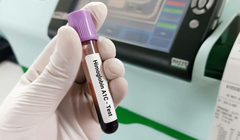 Băuturi naturale pentru creșterea hemoglobinei! Sunt ușor de preparat acasă și oferă beneficii importante