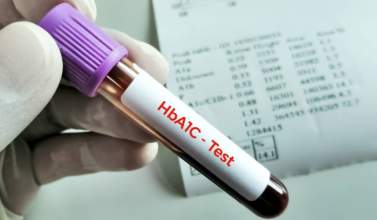 De ce poate crește hemoglobina glicată (HbA1c)? Glicemia ridicată nu este singura explicație