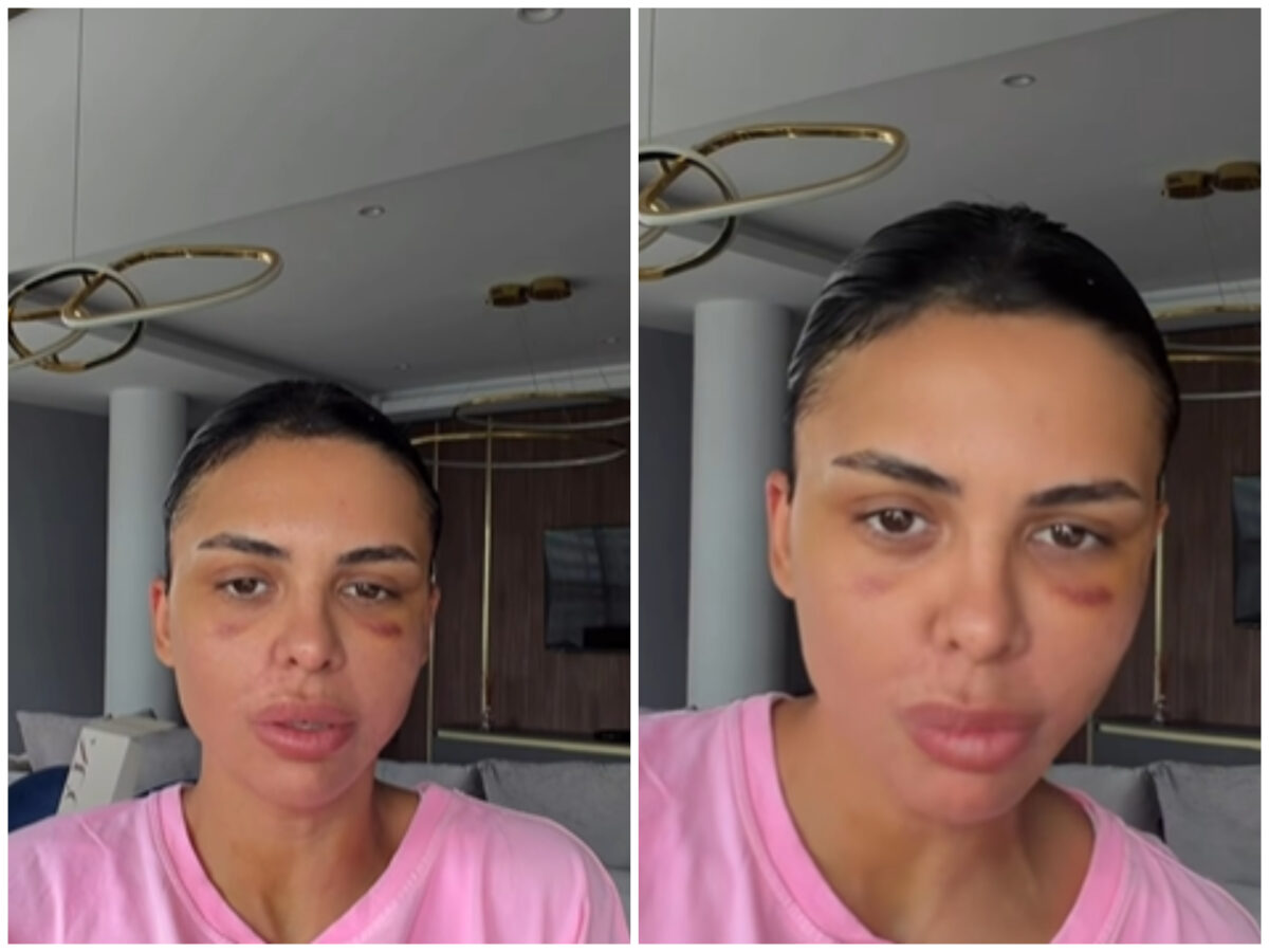 Andreea Popescu, dezvăluiri despre ultimele operații suferite: „Mi-a căzut părul enorm”. Ce intervenții estetice și-a făcut vedeta