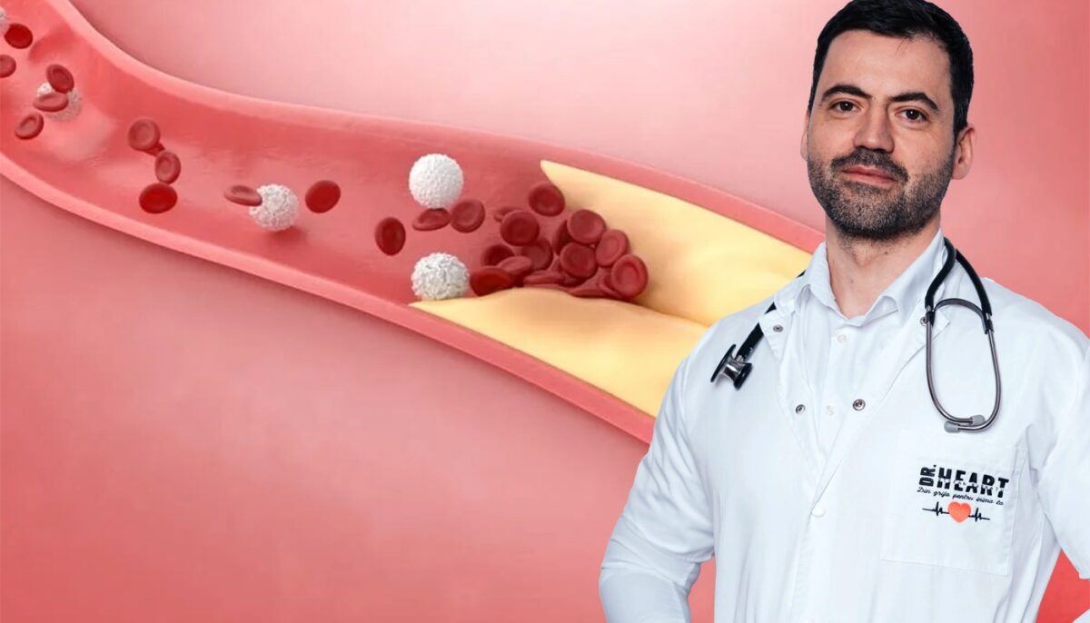 Ce trebuie să facem pentru a ne „desfunda” vasele de sânge, potrivit medicului primar cardiolog Ștefan Busnatu