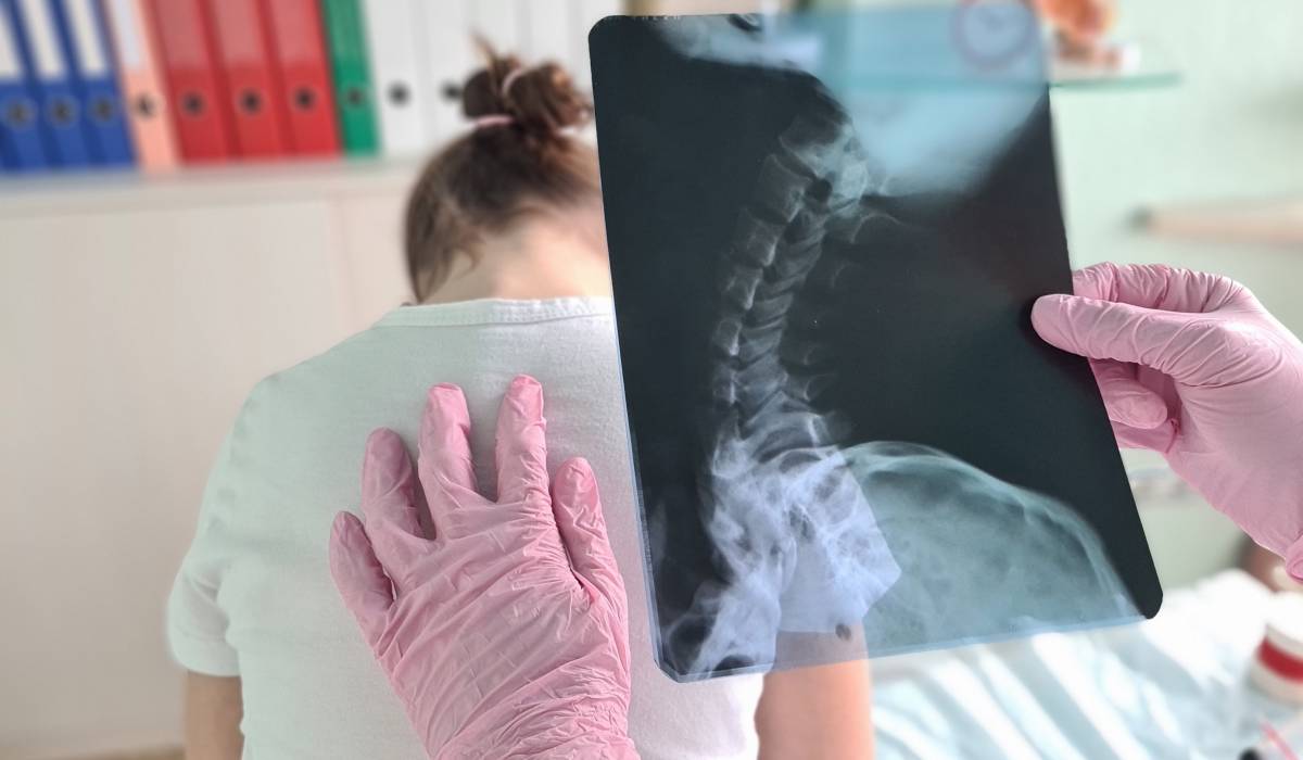 Cum afectează telefonul postura copiilor Osteopat: „Lipsa mișcării este cauza reală, nu telefonul în sine”